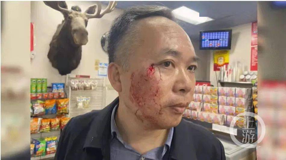 被枪指头,中国教授用功夫击退美国劫匪!当事人这样说