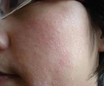 长痘痘让老罗心动的「洗面炭」！1s去油，毛孔清爽，一边洗还能一边做护肤！