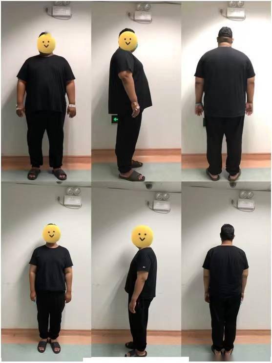 半年减重80斤广州小伙不仅体型变了还成功避开糖尿病