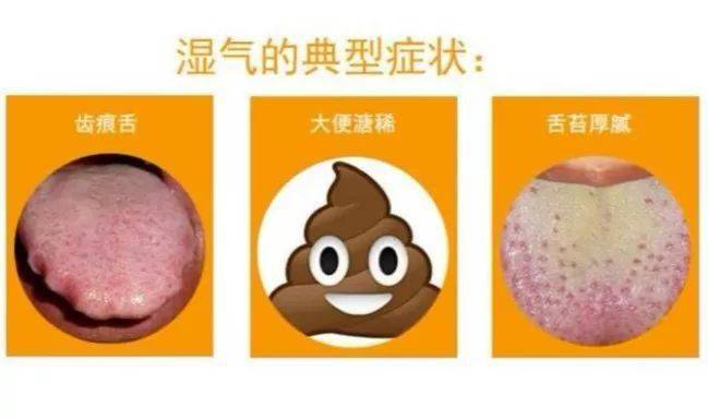 部位|注意：湿气重的人，身上这2个部位会“变大”，再忙也要看看！