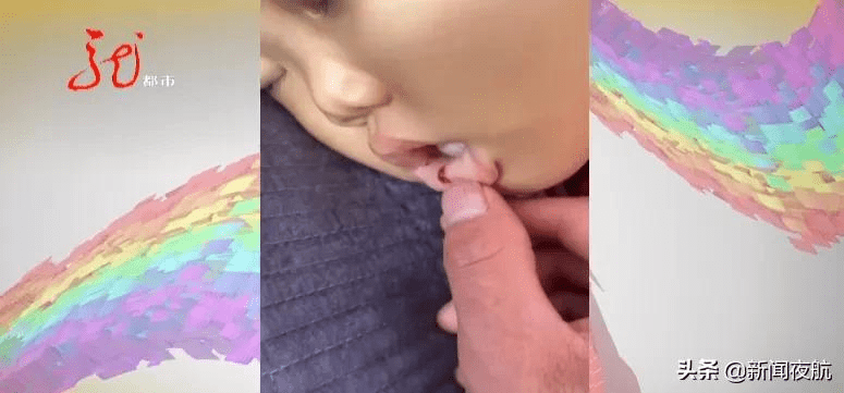 白云瑞|哈尔滨一岁女童浑身淤青、口腔淤血……她不幸被确诊，父母崩溃了