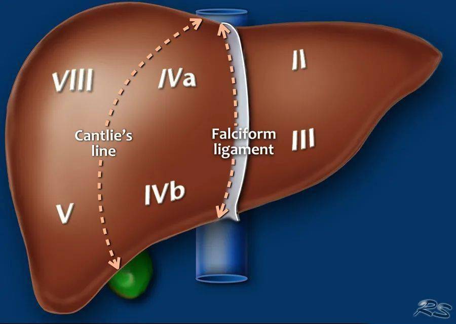 肝脏测量径线示意图图片