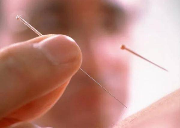 面部|天冷易诱发面瘫，这些症状要注意！