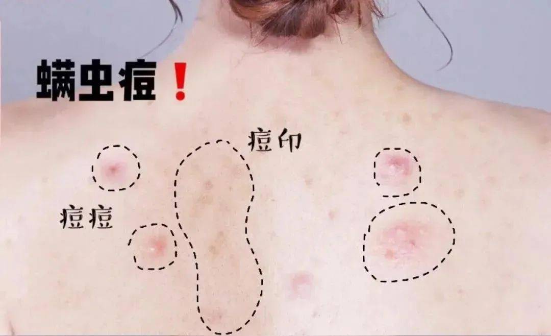 南宁这瓶身体乳还不入手？保湿+锁水+祛痘印！【1074主播严选商城】