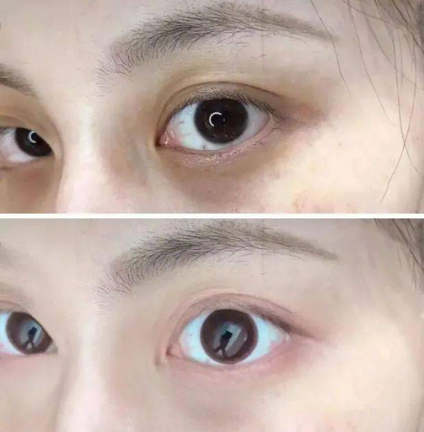 莱雅|理智的成分党都在用什么眼霜抗初老？