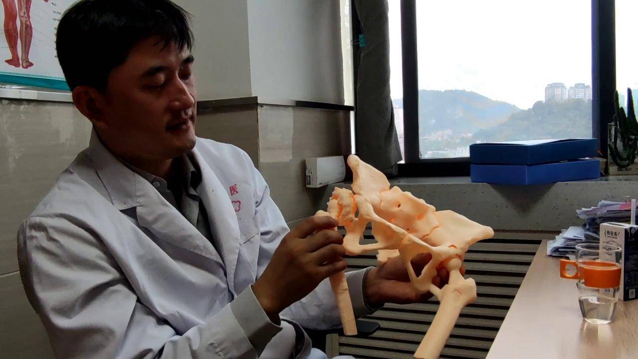 贵州大妈髋关节7年脱位7次省医骨科专家化身灵魂画手3d打印活骨头