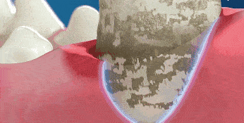 效果|又到火锅季，担心上火？降火神器了解一下