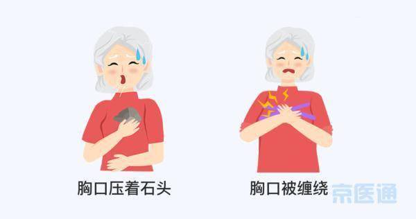 建议|心梗发作5大先兆，大多和电视剧里演的不一样！
