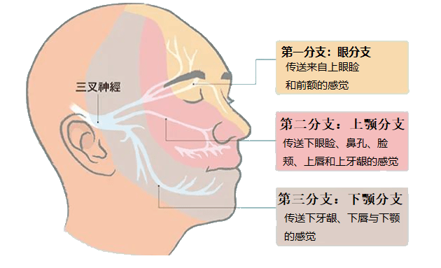 三叉神经痛及其药物治疗