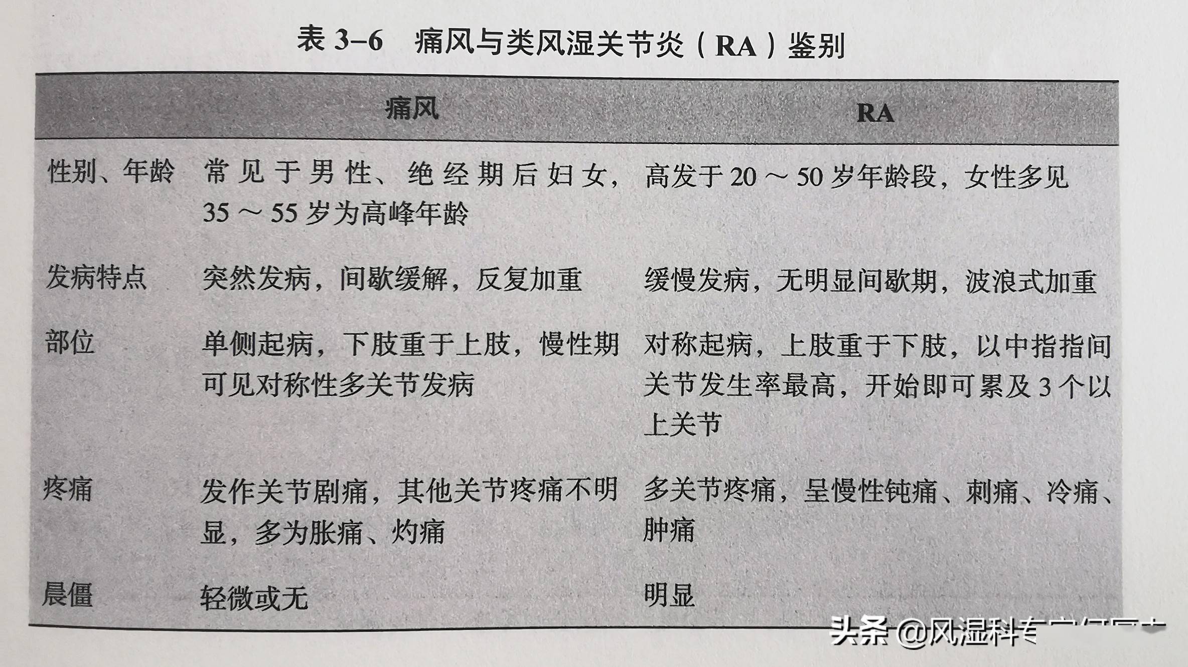 特征性急性关节炎反复发作,痛风石沉积,痛风性慢性关节炎和关节畸形