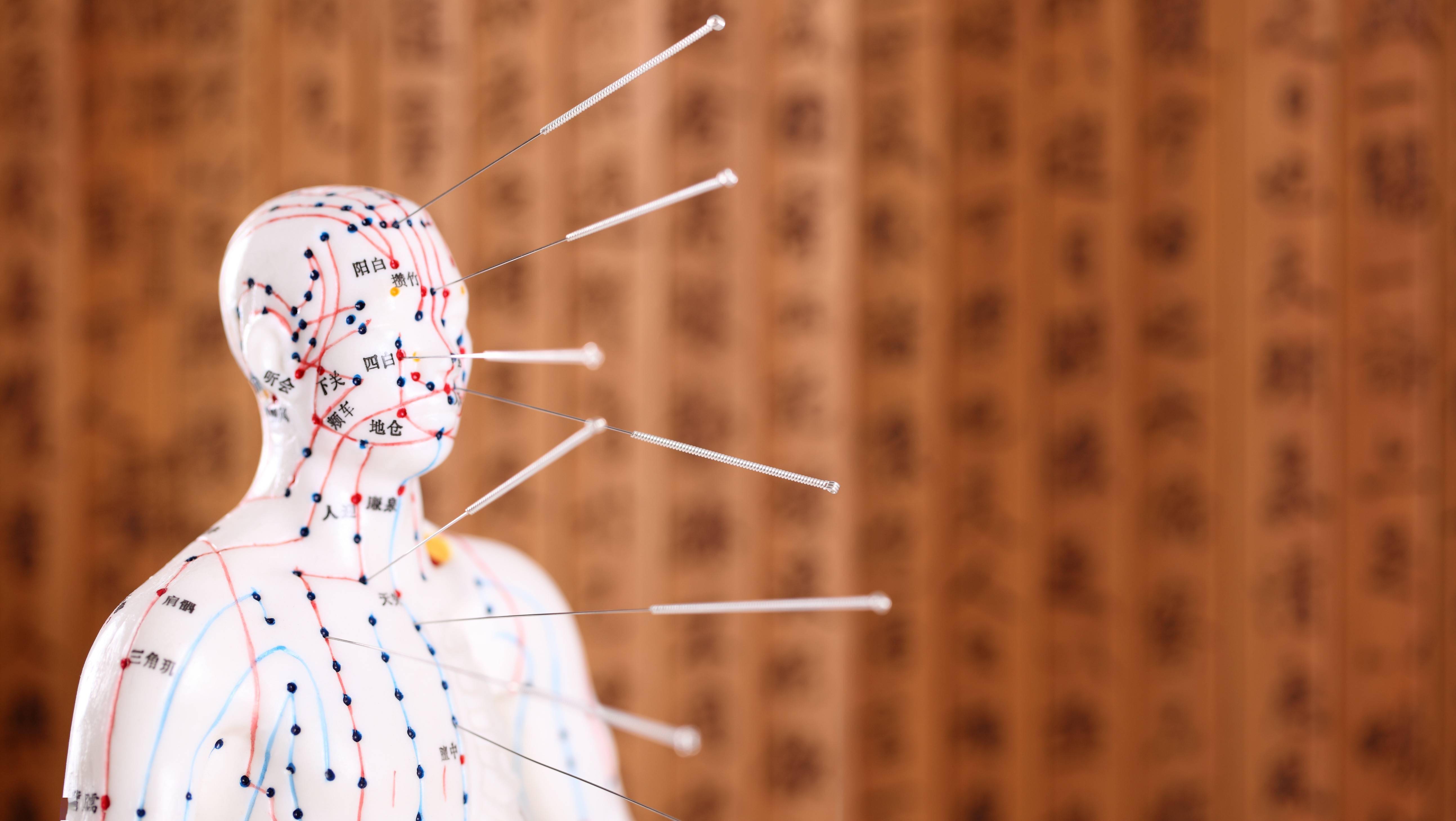 需注意|世界针灸日丨应用广泛、安全可靠，针灸治疗还需注意哪些？