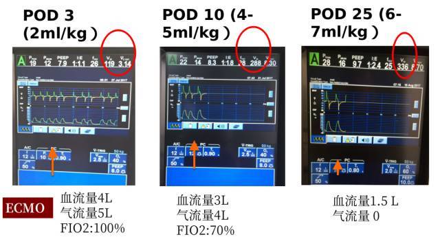 食管|精选病例｜从绝望中寻找希望—镇痛镇静篇