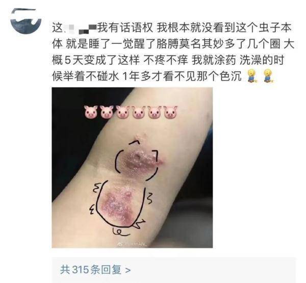 这种虫，是会飞的“硫酸”