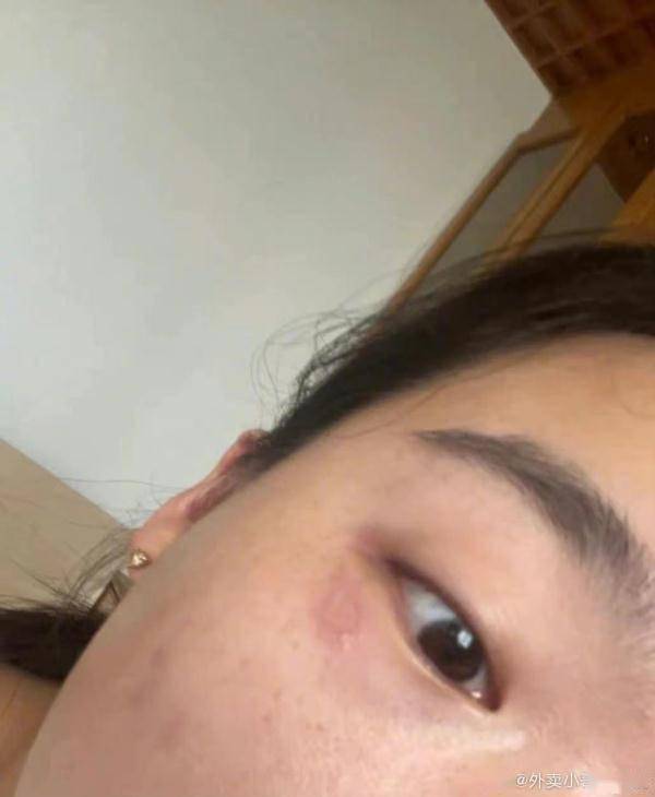 这种虫，是会飞的“硫酸”