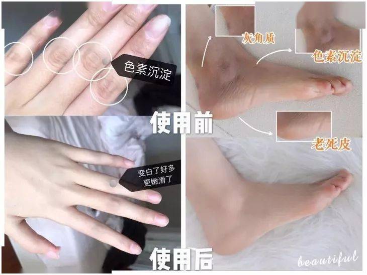 羊奶女生涂身体乳 vs 不涂身体乳，这差别也太大了吧！
