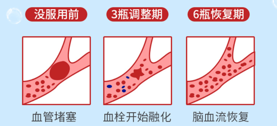 入冬这样做着吃,血管不堵,血液不粘!