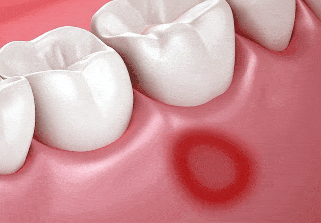 合香丸不仅能从内调养,更可以消除口腔细箘 快速中和异味!