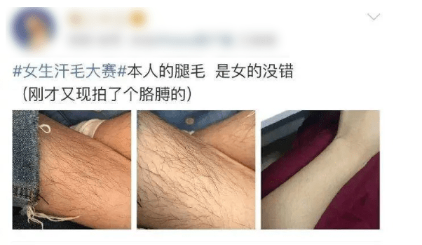 女孩有腿毛怎么办