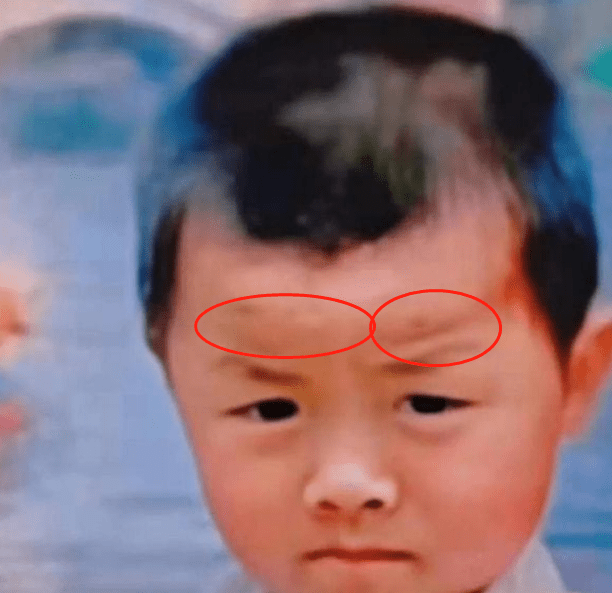 郭威童年照头部流血 网传根源在郭希宽身上 至今视力还只有0 1 杜妈 小时候 照片