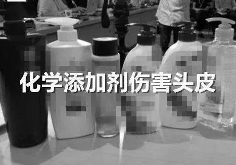 洗头头皮发痒，长出痘痘？ 竟然导致永久性脱发，用它洗头除螨去屑，彻底拯救大油头！