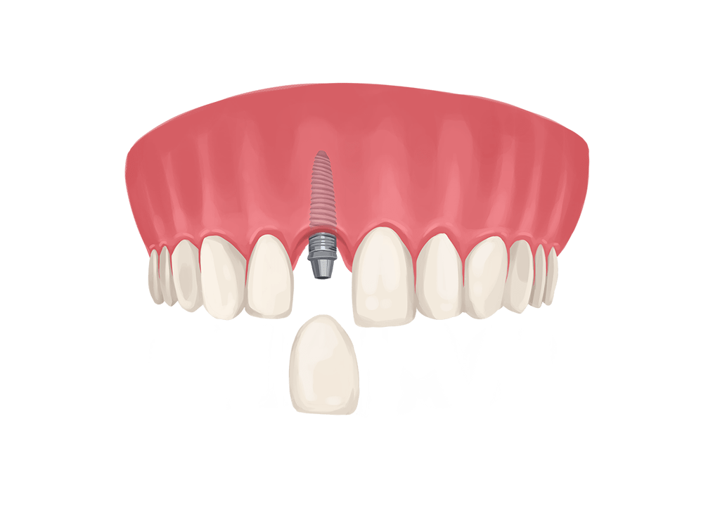 ae6d8e0e4be84f3186230d8b273d86c8.png