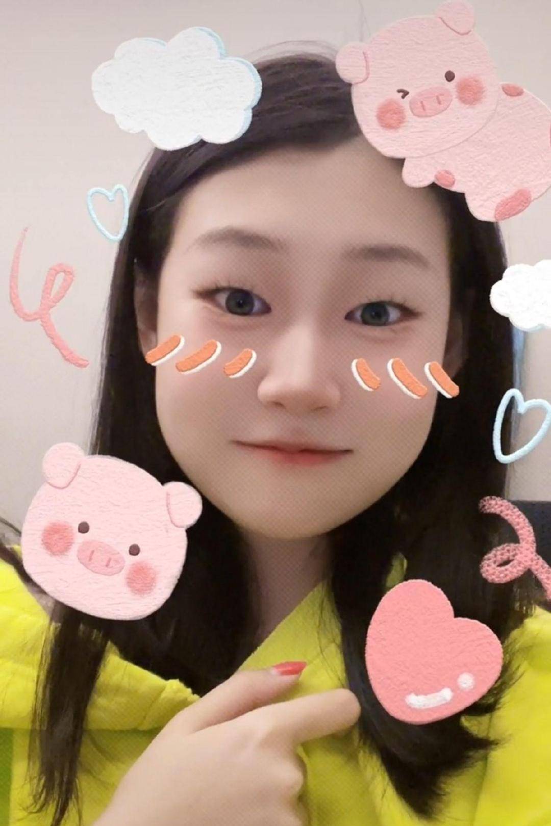 怎么让自己的眼睛变大最快 2bb523e8e0714179914e8f5b340da61a.jpeg