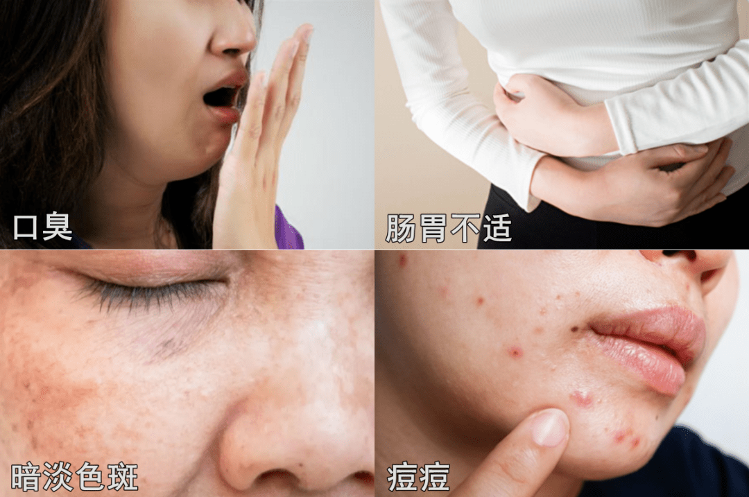 67湿气不走百病生每天两粒它排空10年湿气狂瘦30斤一身轻松年轻20岁