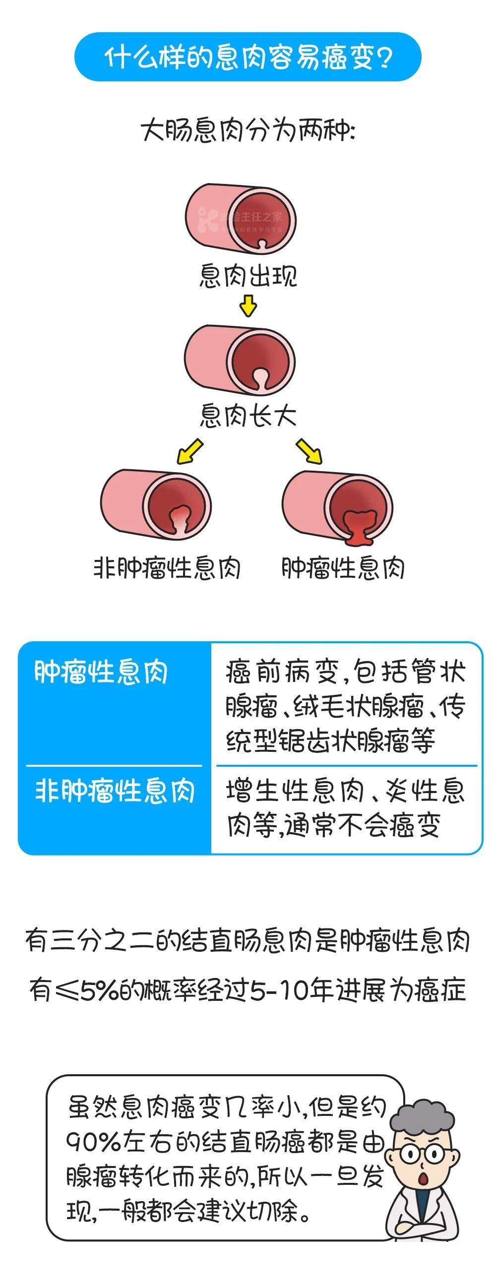 腸息肉很可能癌變發現它的最佳手段居然常被忽視