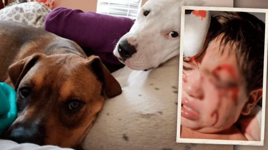 珀斯男孩被两只狗凶狠撕咬伤势让人心惊西澳救生员恳求父母夏天在游泳