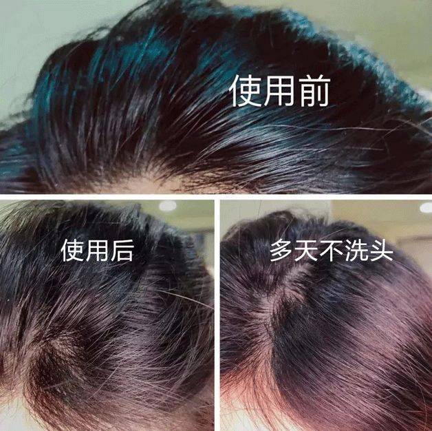 头皮头发总掉竟是「发根」缺了它！简单一招，5天生新发！发量重回18岁