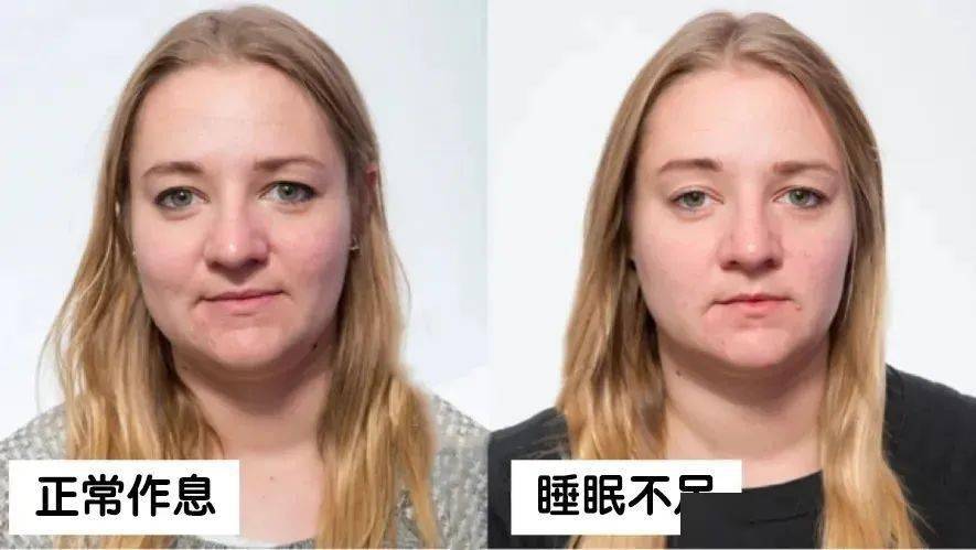 熬夜?这样护肤才不会老得快!