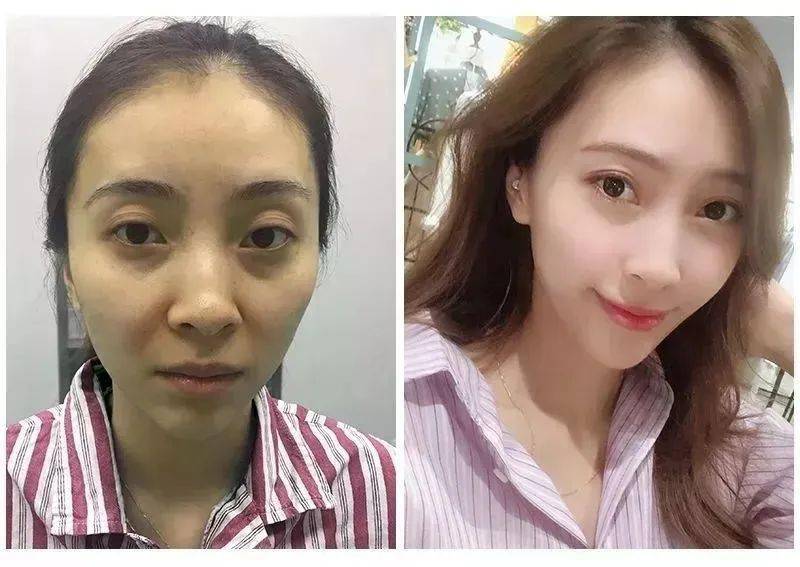 产品女人坚持喝它，肌肤白1度，色斑，暗沉通通消失，皮肤水嫩光滑，别怪我发晚了