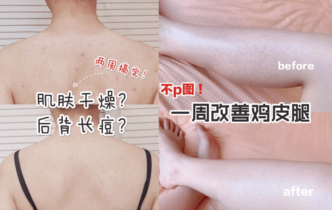 毛孔72岁奶奶私密照曝光，皮肤白嫩如20岁少女，网友：怎么保养的？！