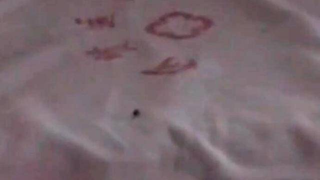 怎么看小孩子有没有虫子 6723a68020f44ccc85311a2e10e19dec.jpeg