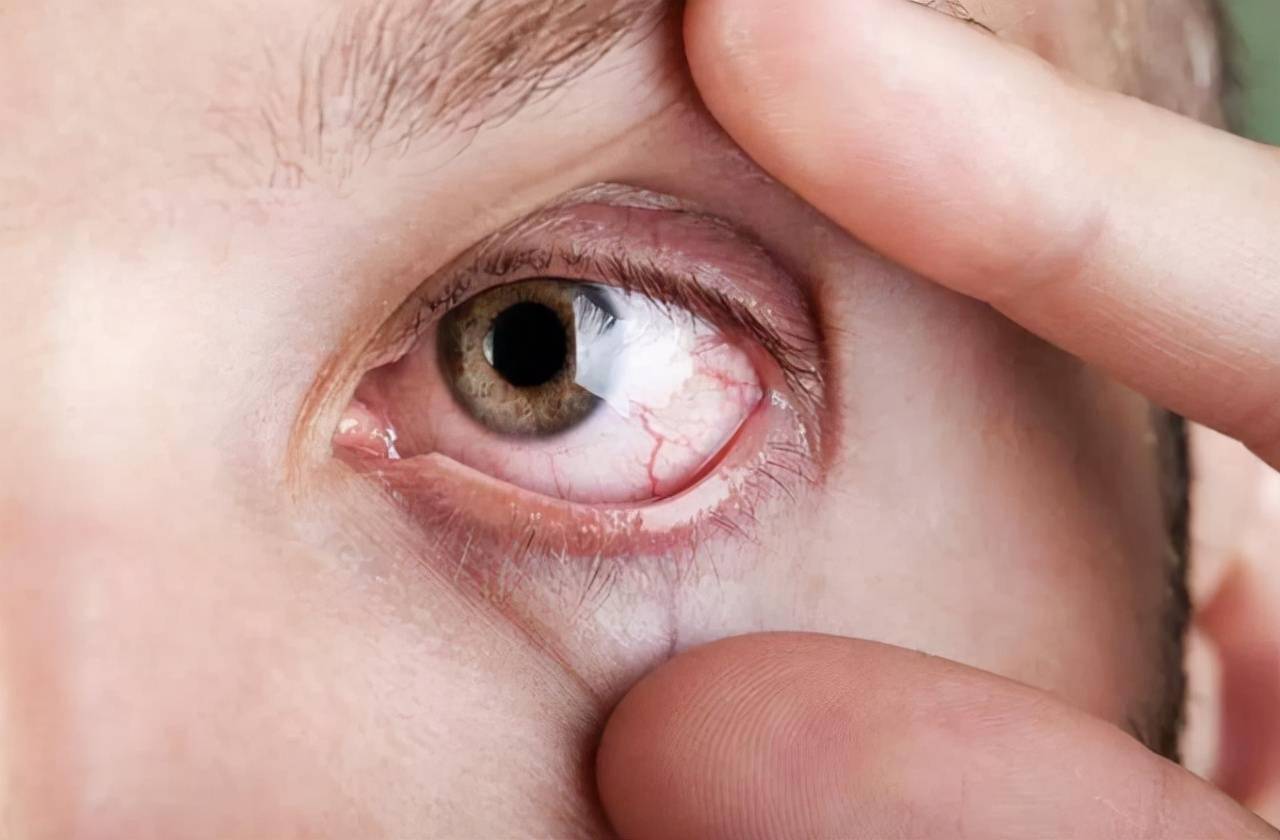 眼睛受到极大的损伤,并发症发生以后眼球的大多数组织,都会因为糖尿病