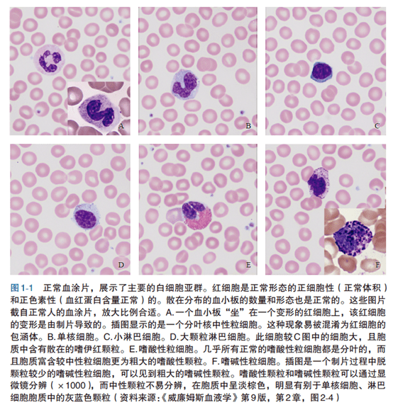 恰当的染色涂片也可以发现红细胞和血小板的形态学特点