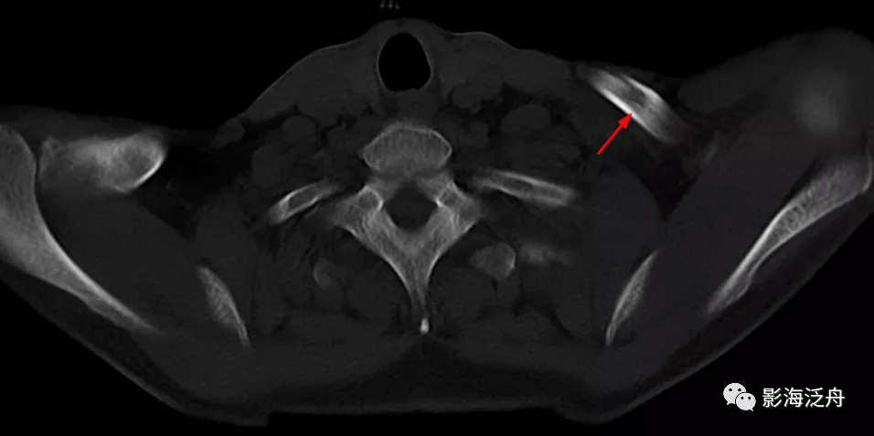 静脉|影像阅片，千万不能“掐头去尾”
