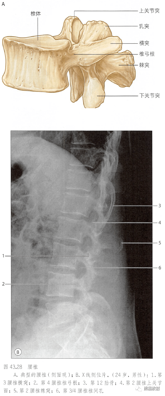 腰椎侧面观图片