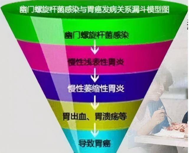 和并发症,但是这些人几乎都存在慢性活动性的胃炎,即幽门螺杆菌胃炎