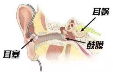 声音|哪些不良习惯会引起耳病？听力损伤如何预防？一起来看→