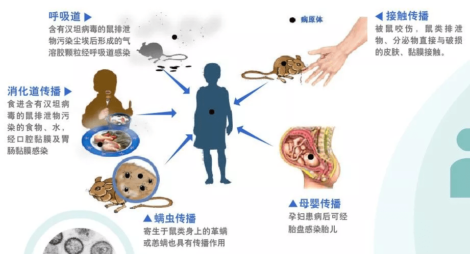 科普|科普：出血热的预防与治疗→