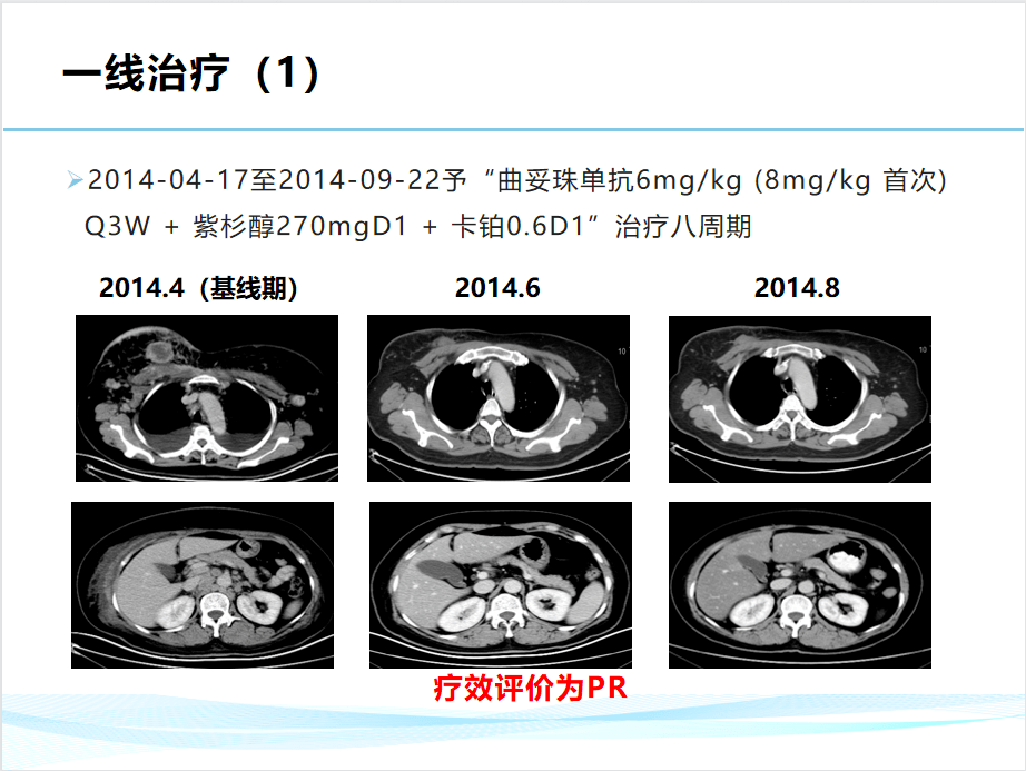 病例報告2018-2019年在美國梅奧診所研修一年江蘇省腫瘤醫院優才獲得