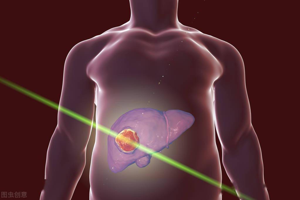 再次強調肝臟是啞巴器官身體這三種表現或是肝癌前兆