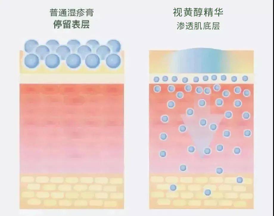 作用长了脂肪粒到底挤不挤?一分钟教你处理它的正确姿势!