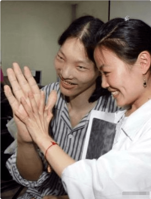 第一女巨人姚德芬身高24米最大心愿是吃饱饭她经历了啥