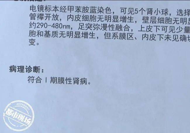 化妆品网购护肤品汞超标致花季少女得肾病？厂家、卖家都不认…