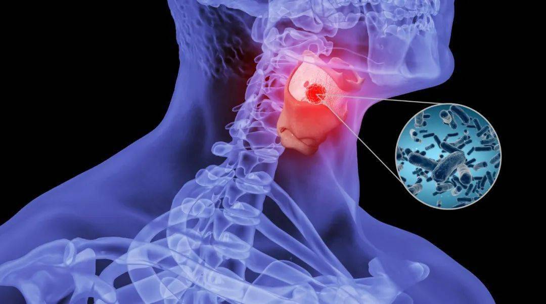 办事|吓坏！福建男子咽痛喝下双黄连后差点丧命！这种厦门人冬天的常见症状，可能真的会让你“一炎封喉”...