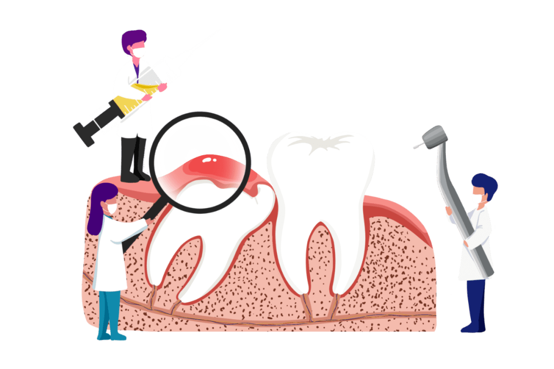 2)智齿冠周炎,磨牙后垫软组织肿胀,张口受限;1)牙髓炎,遇冷热刺激痛