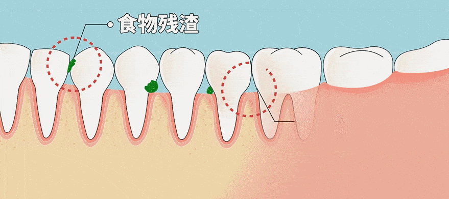 牙膏|表白一万遍都不够！“王老吉牙膏”来了！怕上火刷王老吉！