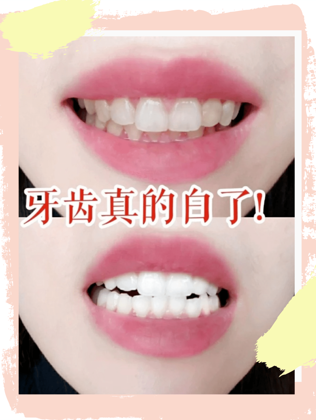 牙膏|表白一万遍都不够！“王老吉牙膏”来了！怕上火刷王老吉！